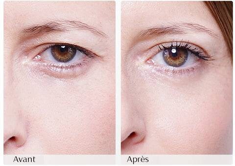 80 patchs beige peau lifting paupières tombantes